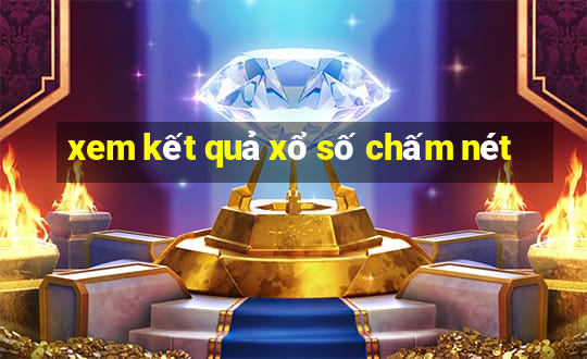 xem kết quả xổ số chấm nét