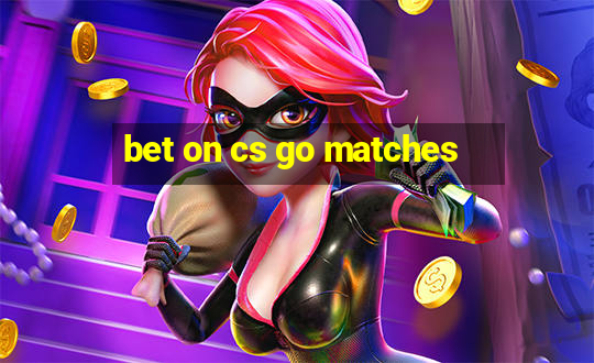 bet on cs go matches