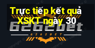 Trực tiếp kết quả XSKT ngày 30