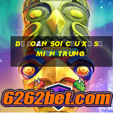 dự đoán soi cầu xổ số miền trung