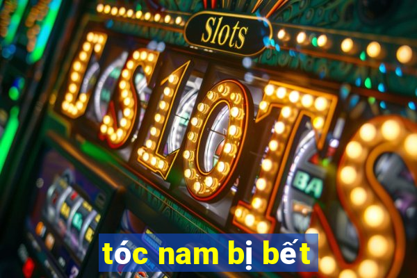 tóc nam bị bết