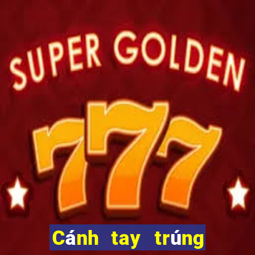 Cánh tay trúng xổ số