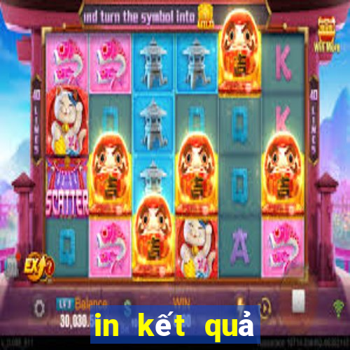 in kết quả xổ số miền nam