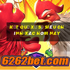 kết quả xổ số siêu chính xác hôm nay