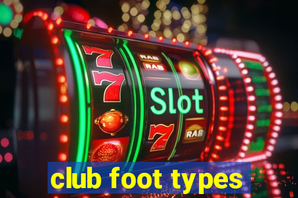 club foot types