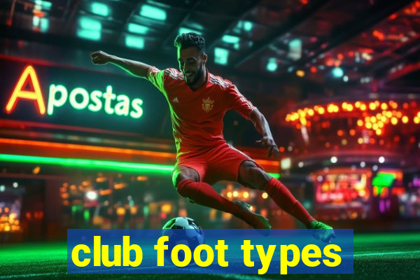 club foot types